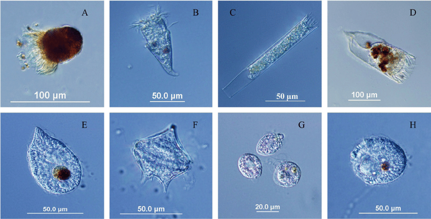 4400 Gambar Protista Mirip Hewan (Protozoa) HD